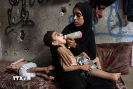 Trẻ em Palestine tại Dải Gaza bị suy dinh dưỡng nghiêm trọng. (Ảnh: THX/TTXVN)