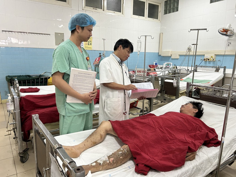 Bệnh nhân Hoàng Thanh M. (50 tuổi) bị bỏng điện độ 3-4 vùng cẳng chân hai bên, đùi phải, bàn tay trái, diện tích khoảng 10%. (Ảnh: Mai Trang/TTXVN)