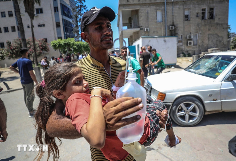 Em nhỏ bị thương sau cuộc không kích của Israel tại Gaza. (Ảnh: THX/TTXVN)