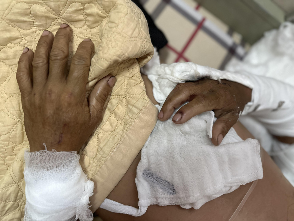 Tuy nhiên, sau khi bệnh nhân được các bác sỹ cấp cứu điều trị và các quân nhân truyền máu trực tiếp, bệnh nhân đã vượt qua cơn nguy kịch, không phải cắt bỏ cánh tay và được vận chuyển vào đất liền để điều trị chuyên sâu tiếp. (Ảnh: Thùy Giang/Vietnam+)