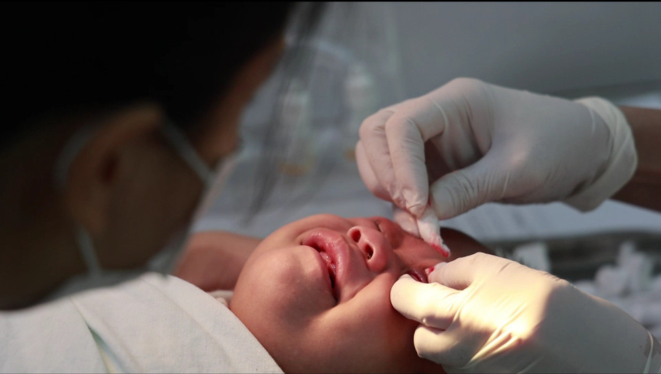 Nhân viên y tế thực hiện thủ thuật bóc giả mạc cho bé. (Ảnh: T.G/Vietnam+)