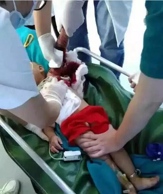 Bác sỹ đang cấp cứu cho cậu bé với cánh tay đầy máu. (Nguồn: QQ)