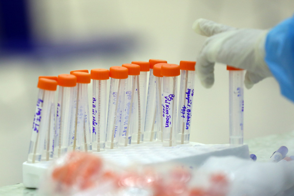 Tổng số mẫu xét nghiệm âm tính người từ 12 tỉnh thành và vùng dịch, tính đến chiều 21/2 là 34.600. (Ảnh: Huy Hùng/TTXVN)