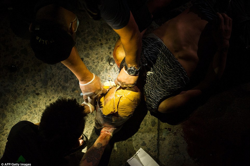 Một tên tội phạm bị người dân trừng phạt bằng cách dán băng dính quanh đầu. (Nguồn: Dailymail)