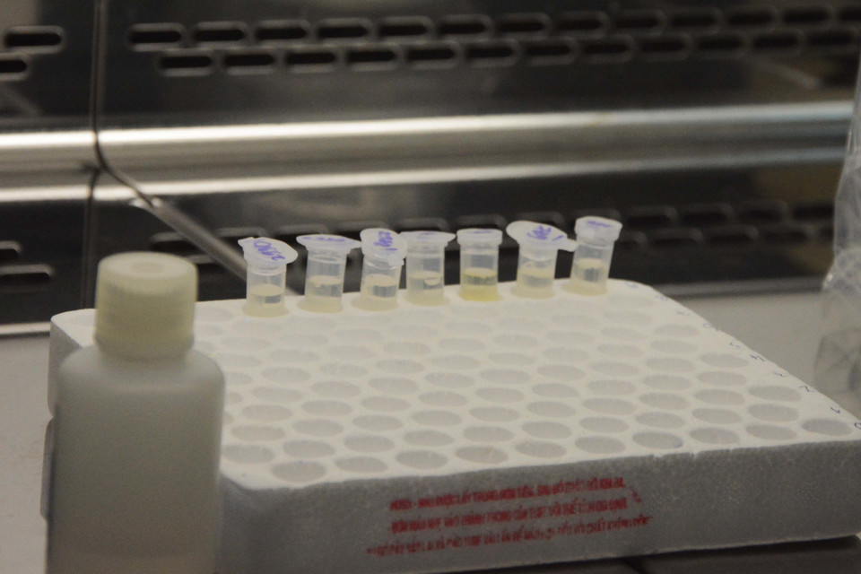 Cận cảnh các mẫu xét nghiệm dịch bệnh. (Ảnh: Văn Dũng/TTXVN)