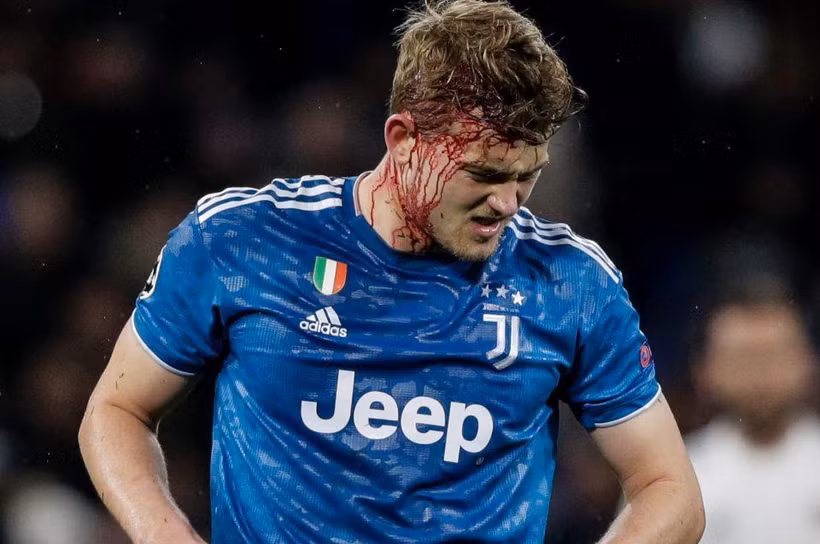 Trung vệ De Ligt gặp chấn thương vùng đầu trong trận Juventus thua 0-1 Lyon rạng sáng 27/2. (Ảnh: Getty Images)