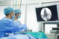Bác sỹ Bệnh viện Chợ Rẫy thực hiện phẫu thuật lấy khối u tuyến yên khổng lồ cho bệnh nhân bằng Hệ thống phẫu thuật nội soi thần kinh hiện đại. (Ảnh: TTXVN phát)