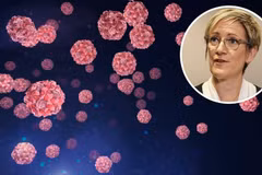 Tiến sỹ Clare Huppatz, Giám đốc Sở Y tế của bang Tây Australia, cho biết nhiều khả năng virus bắt nguồn từ một người đã đi du lịch nước ngoài. (Nguồn: Perthnow)
