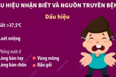 Bệnh tay chân miệng: Dấu hiệu nhận biết, nguồn truyền bệnh và cách phòng chống