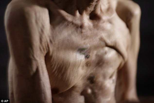 Khi quả bom nguyên tử nặng 5 tấn mang tên “Fat Man” được thả xuống Nagasaki, nằm phía Tây đảo Kyushu, cụ Taniguchi mới chỉ 16 tuổi.