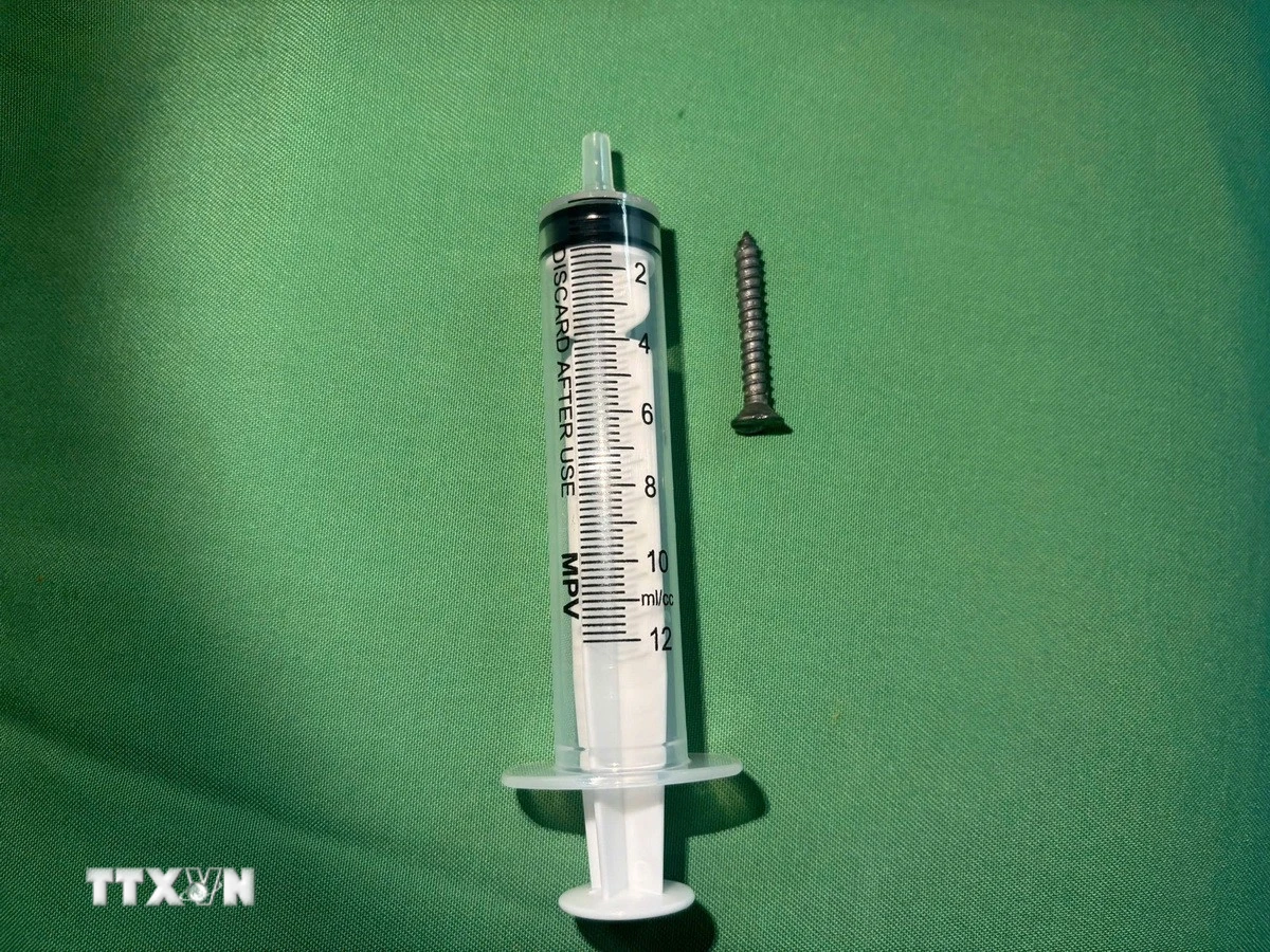 Quảng Trị: Cứu thành công bé 21 tháng tuổi nuốt đinh vít sắc nhọn dài 2,5cm