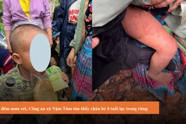 Cháu bé được tìm thấy với nhiều vết xước trên cơ thể. (Nguồn: Công an tỉnh Lai Châu)