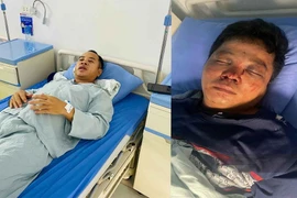 Hai anh em anh Vĩnh, anh Trung nhập viện sau khi bị hành hung. (Ảnh: Nhân vật cung cấp)