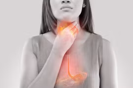 Triệu chứng ợ nóng do trào ngược dạ dày gây khó chịu. (Ảnh: iStock)
