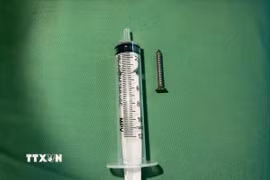 Chiếc đinh vít dài 2,5cm nằm trong dạ dày bệnh nhân nhi. (Ảnh: TTXVN phát)