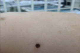 Ảnh minh họa. (Nguồn: TTXVN)