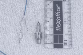 Dị vật là dụng cụ nha khoa bằng kim loại dài 2,5 cm được các bác sỹ lấy ra khỏi phế quản của bệnh nhân. (Ảnh: PV/Vietnam+)