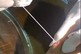 Đoạn giun rồng kéo ra từ cánh tay anh T. dài khoảng 10-15cm do người nhà tự nặn. (Ảnh: PV/Vietnam+) 