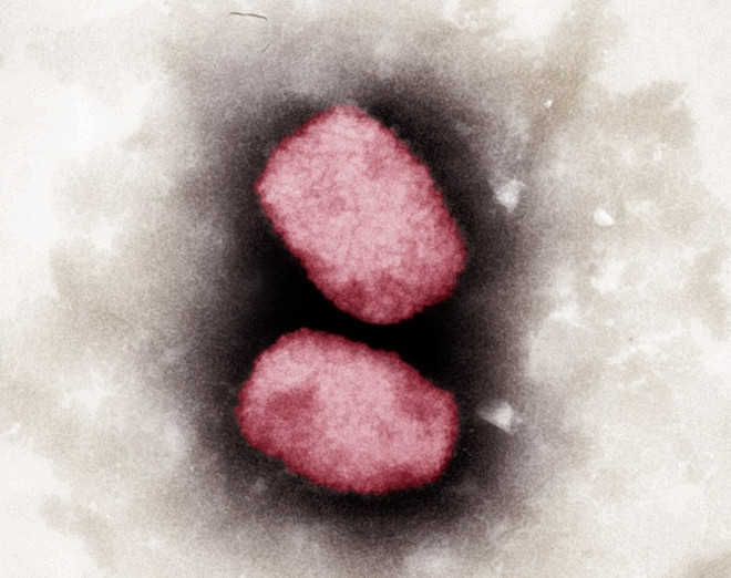 EU xúc tiến mua vaccine và thuốc điều trị bệnh đậu mùa khỉ ảnh 1