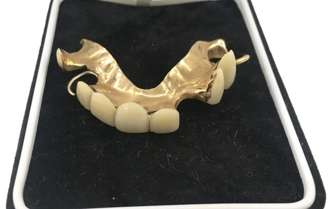 Churchill gặp vấn đề về răng miệng trong suốt cuộc đời và mất vài chiếc răng ở độ tuổi 20. (Nguồn: The Telegraph) rang gia_churchill.jpeg