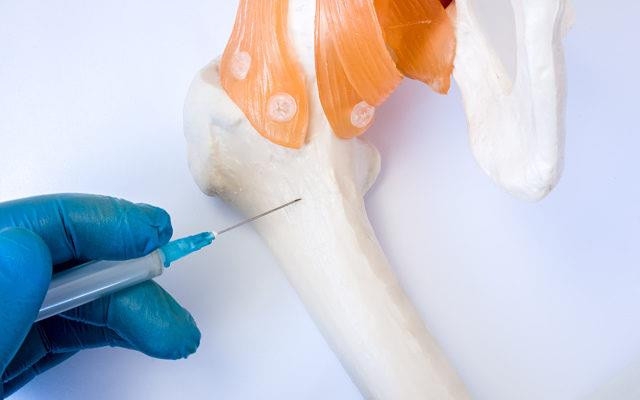 Nga thử nghiệm cấy ghép xương bằng kỹ thuật tế bào thế hệ mới ảnh 1