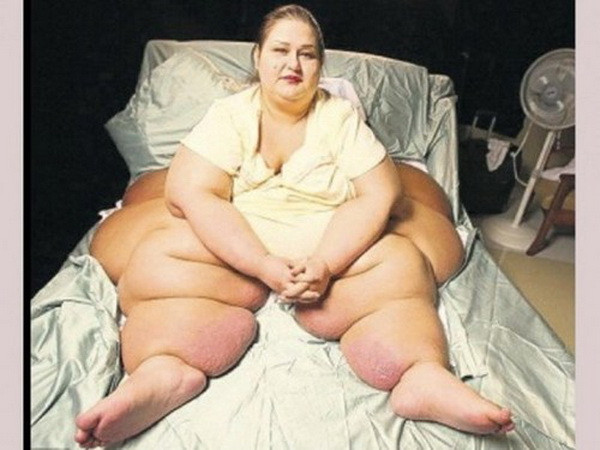 Câu chuyện kinh ngạc về cô gái tập luyện chăm chỉ để giảm 400kg ảnh 5