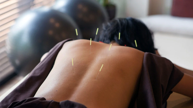 Phương pháp châm cứu có thể giúp giảm đau trong phẫu thuật ung thư ảnh 1