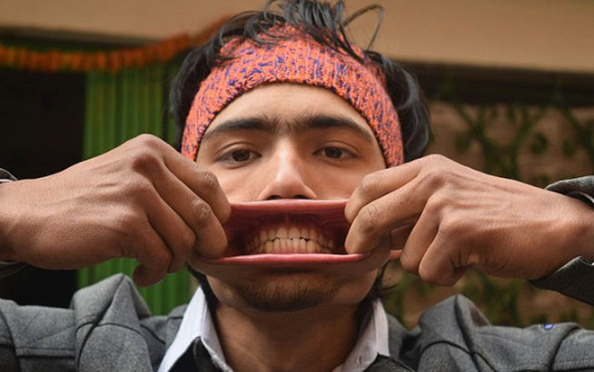 [Photo] Kinh ngạc trước cái "miệng không đáy" của chàng trai 18 tuổi ảnh 2