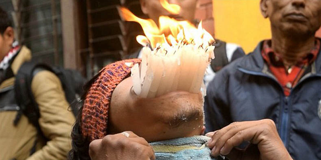 [Photo] Kinh ngạc trước cái "miệng không đáy" của chàng trai 18 tuổi ảnh 4