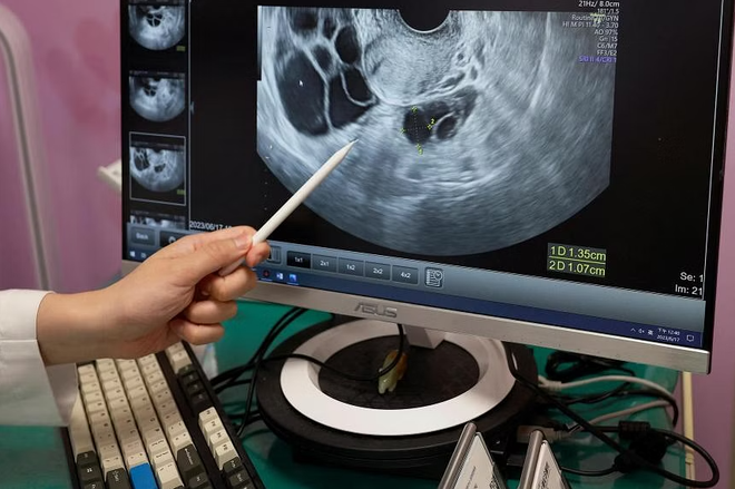 Vì sao phụ nữ hòn đảo Đài Loan rủ nhau đi làm đông lạnh trứng? ảnh 2