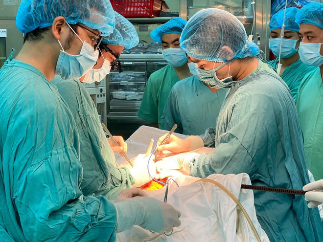Kíp mổ Bệnh viện Trung ương Huế phẫu thuật lấy thanh sắt ra khỏi người bệnh nhân. (Nguồn: TTXVN phát) Cứu sống nam lao động bị thanh sắt đâm thủng phổi ảnh 1