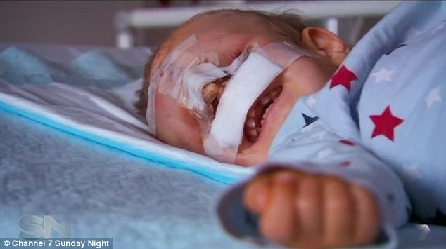 Bé trai Maroc có khuôn mặt dị dạng đã có một cuộc đời khác ảnh 3