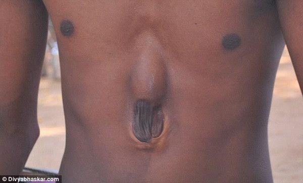 Xót thương chàng trai nghèo có trái tim nằm ngoài cơ thể ảnh 1