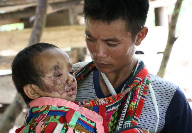 Tập trung phòng chống dịch bệnh tại vùng lũ quét Mường La ảnh 1