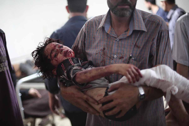 [Photo] Những bức hình ám ảnh về các nạn nhân trẻ em tại Syria ảnh 3