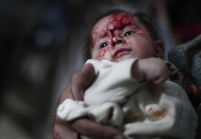 [Photo] Những bức hình ám ảnh về các nạn nhân trẻ em tại Syria ảnh 23