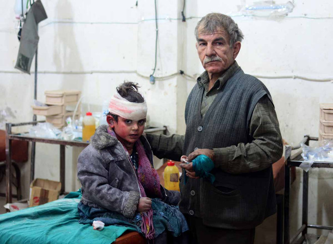 [Photo] Những bức hình ám ảnh về các nạn nhân trẻ em tại Syria ảnh 18