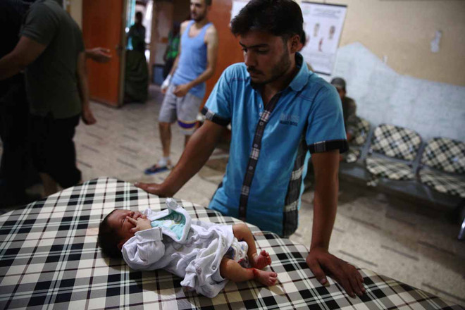 [Photo] Những bức hình ám ảnh về các nạn nhân trẻ em tại Syria ảnh 20