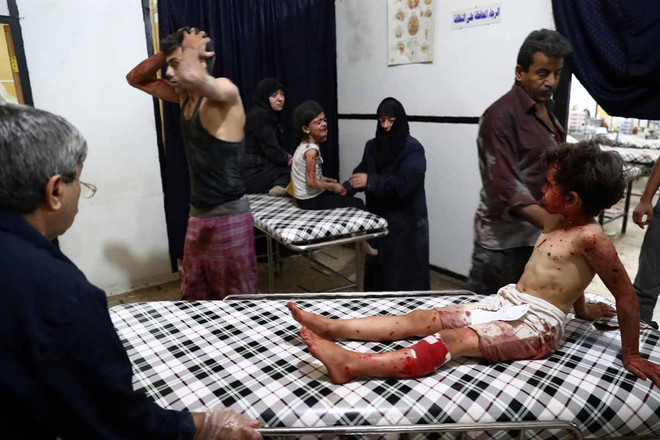 [Photo] Những bức hình ám ảnh về các nạn nhân trẻ em tại Syria ảnh 19