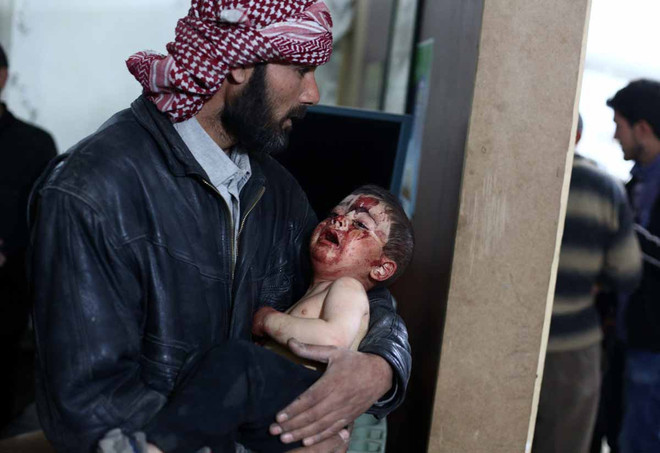 [Photo] Những bức hình ám ảnh về các nạn nhân trẻ em tại Syria ảnh 16