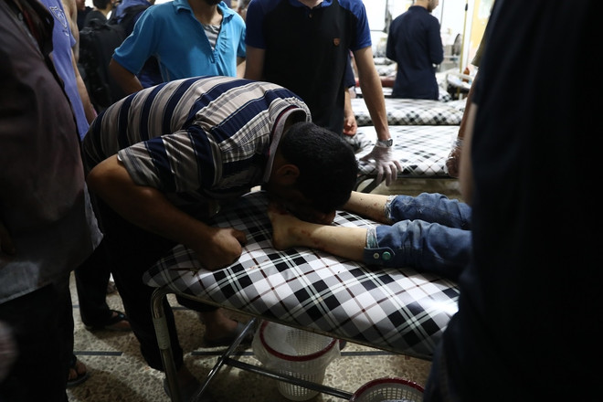 [Photo] Những bức hình ám ảnh về các nạn nhân trẻ em tại Syria ảnh 14