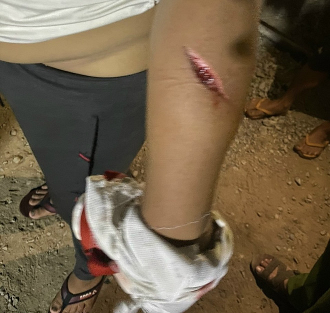 Sóc Trăng: Triệu tập đối tượng tấn công các bảo vệ tại dự án điện gió ảnh 2