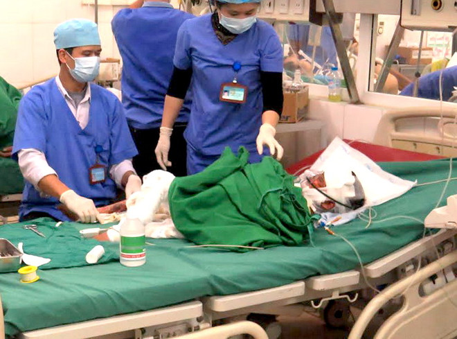 Xót xa cháu bé 7 tuổi người dân tộc Mông bị bỏng nặng vì bếp gas ảnh 1