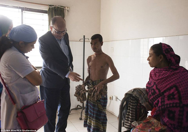 [Photo] Xót xa chứng kiến căn bệnh "người cây" quái ác hiếm gặp ảnh 4