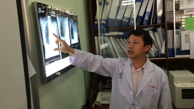 Gắp thành công dị vật đường thở cho bệnh nhân sau 4 lần ngưng thở ảnh 1