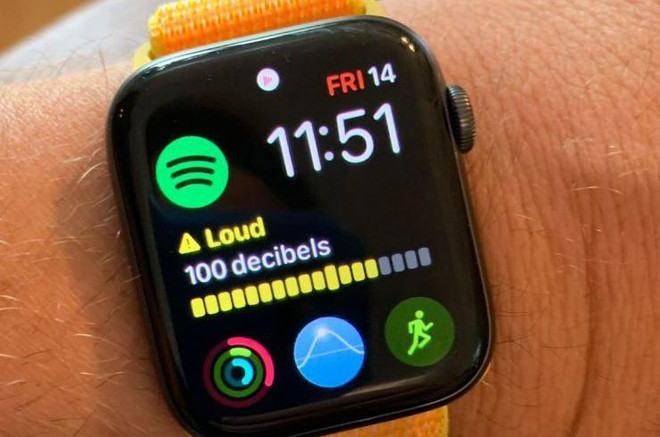 (Nguồn: CNBC) Apple Watch sắp có tính năng giúp bảo vệ thính giác của người dùng ảnh 1