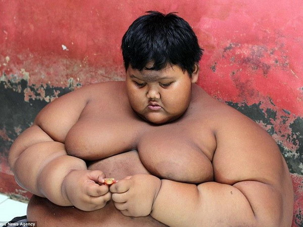 Mở lớp học ngay tại bệnh viện cho cậu bé béo nhất thế giới ảnh 1