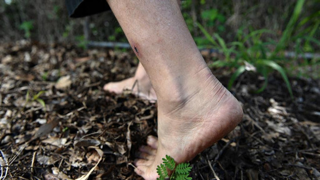 Bộ Y tế khuyến cáo phòng tránh bệnh Whitmore "vi khuẩn ăn thịt người" ảnh 1