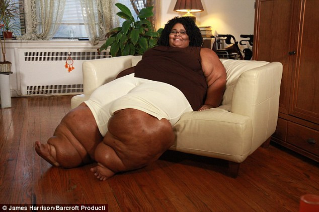 Xót thương cho số phận nghiệt ngã của người phụ nữ "chân voi" ảnh 1