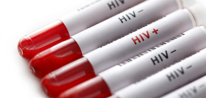 Phát hiện thuốc điều trị ung thư phổi có thể tiêu diệt các tế bào HIV ảnh 1